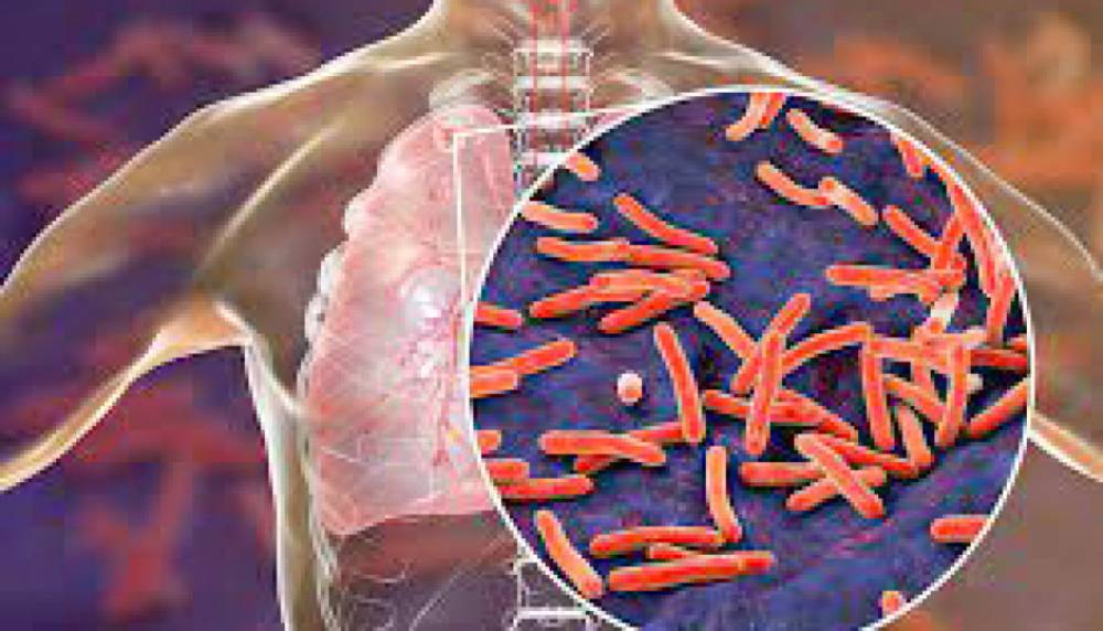 Saúde alerta a população sobre a tuberculos